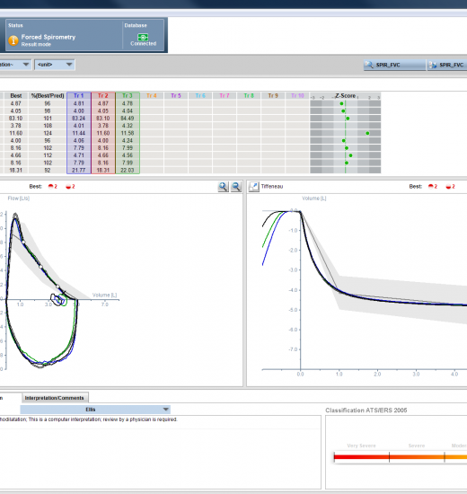 Vyntus SPIRO PC Spirometer | Duomed